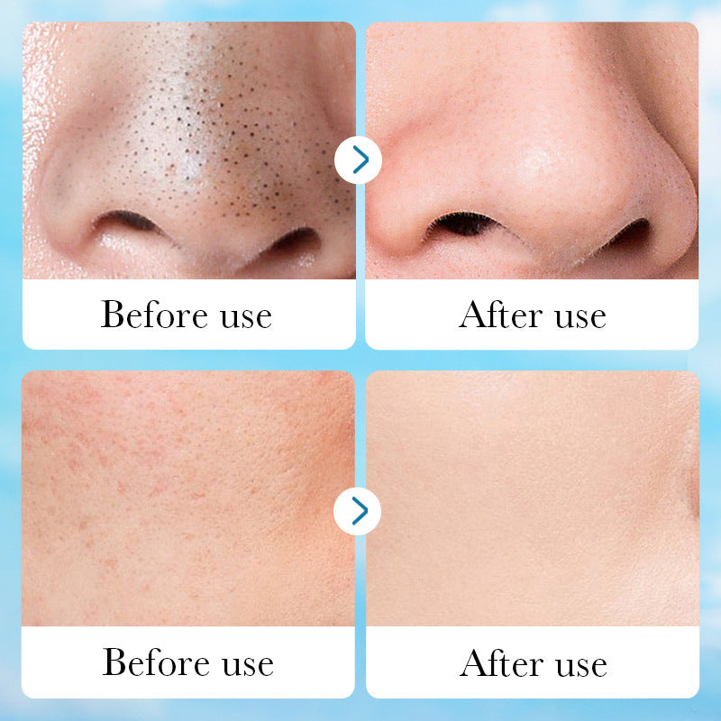 Aloe Pore Clear Solid Mask - Deep Cleansing Treatment